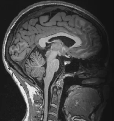 TSD hjerneavbildings prosessering